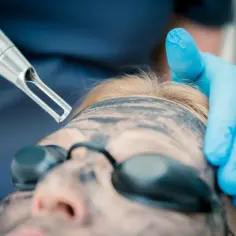 Peeling węglowy co daje: zaskakujące efekty dla Twojej skóry