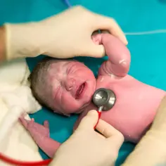 Noworodek po urodzeniu, z zaczerwienioną skórą, płacze, gdy lekarz osłuchuje jego serce stetoskopem.