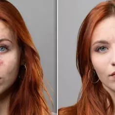 Jak skutecznie zmienić bladą cerę na zdrową i promienną?