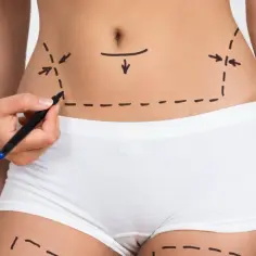 Liposukcja kawitacyjna po jakim czasie efekty? Oczekuj szybkich zmian