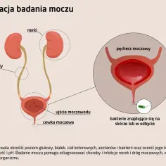 Schemat układu moczowego. W powiększeniu widoczne bakterie, które mogą wskazywać na leukocyty w moczu.