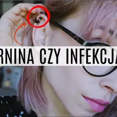 Jak skutecznie leczyć ziarninę po piercingu i uniknąć powikłań