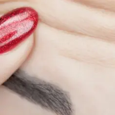 Jak często można robić botox, aby uniknąć niepożądanych efektów?