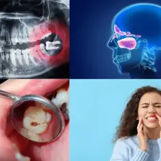 RTG zęba z bólem, schemat zatok, zepsuty ząb w lusterku dentystycznym i kobieta cierpiąca na ból ucha od zęba.