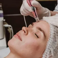Co lepsze: dermapen czy laser frakcyjny - porównanie efektów i korzyści