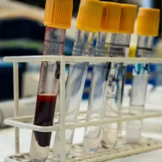 Jakie badania przed oddaniem krwi? Kluczowe testy dla bezpieczeństwa dawcy