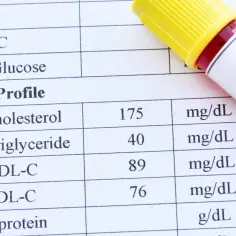 Wynik lipidogramu: cholesterol 175 mg/dL, trójglicerydy 40 mg/dL, HDL-C 89 mg/dL, LDL-C 76 mg/dL. Wyniki wskazują na prawidłową normę cholesterolu.