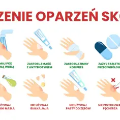 Instrukcje leczenia oparzeń skóry: chłodna woda, maść z antybiotykiem, zimny kompres, tabletki przeciwbólowe, sok z aloesu. Unikaj masła, jajka, pasty do zębów, lodu.