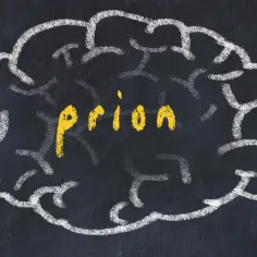 Rysunek mózgu kredą, w środku żółty napis "prion". Choroba kuru to jedna z chorób wywoływanych przez priony.