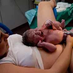 Czy pępowina rośnie? Zaskakująca prawda o jej zmianie u niemowlęcia