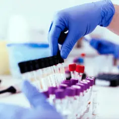 Ręce w niebieskich rękawiczkach przygotowują probówki do analizy. To ważny etap w procesie, jakim jest test na narkotyki.