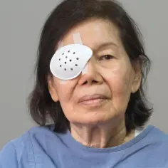 Starsza kobieta z zasłoniętym jednym okiem po operacji zaćmy. Delikatne mycie głowy po zabiegu jest kluczowe dla rekonwalescencji.