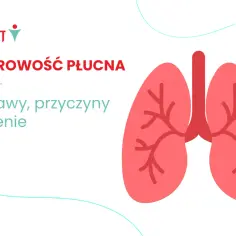 Zatorowość płucna: objawy, przyczyny i leczenie. Grafika przedstawia stylizowane płuca.