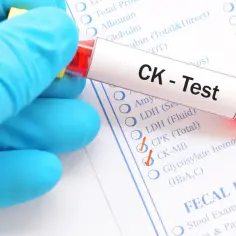 Rękawiczka w niebieskiej rękawiczce trzyma probówkę z krwią do testu CK (kinaza kreatynowa), zaznaczonego na formularzu badania.
