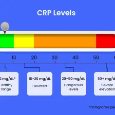 Wykres poziomu CRP: <10 mg/dL to norma, 10-20 mg/dL to podwyższony poziom, 20-50 mg/dL to niebezpieczne stężenie, a powyżej 50 mg/dL to poważne podwyższenie.