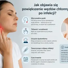 Kobieta dotyka szyi, gdzie widoczne jest zaczerwienienie, wskazujące na powiększone węzły chłonne. Obraz przedstawia objawy infekcji.