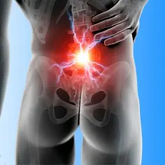 Anatomical illustration of lower back pain with radiating lightning bolts.