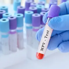 Rękawiczka w niebieskiej rękawiczce trzyma probówkę z napisem "MPV - Test". Tło wypełniają inne probówki.
