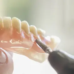 Dentyści dopracowują protezę acetalową, nadając jej idealny kształt.