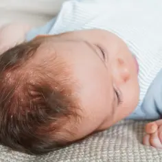 Śpiące dziecko z ciemieniuchą na głowie, delikatne łuski widoczne wśród włosków.