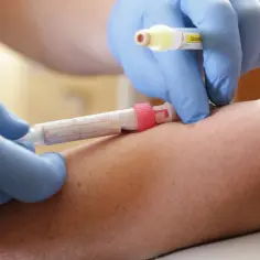 Co to jest lymph w badaniu krwi? Znaczenie i normy limfocytów