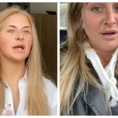Kobieta opowiada o swojej nieudanej laminacji brwi, pokazując efekt na twarzy.