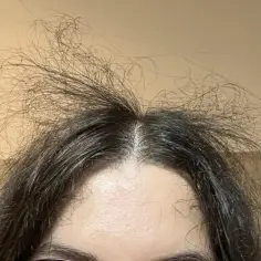 Rozwichrzone baby hair sterczą na czubku głowy, tworząc artystyczny nieład.