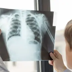 Sylwetka serca lewokomorowa – co to znaczy i jakie niesie zagrożenia