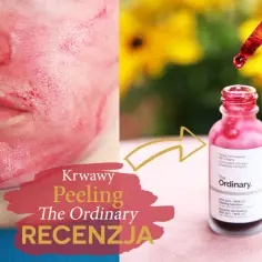 Twarz po zastosowaniu krwawego peelingu The Ordinary. Obok buteleczka z produktem i pipetka z czerwonym płynem.