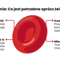 Anemia: co jeść przy anemii? Witamina B12, kwas foliowy, witamina A i miedź są kluczowe. Znajdziesz je w rybach, jajach, szpinaku, marchwi i orzechach.