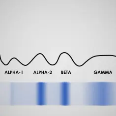 Wykres elektroforezy białek surowicy: wysoki pik albuminy, niższe piki alfa-1, alfa-2, beta i gamma globulin.