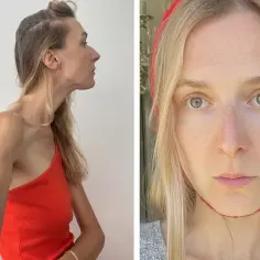 Dwie fotografie kobiety: z profilu w pomarańczowej bluzce i przodem, z czerwonym opaską na głowie. Naturalna uroda, make up no make up.