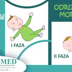 Ilustracja pokazuje dwie fazy odruchu Moro u niemowląt: pierwszą, gdzie dziecko jest wyciągnięte, i drugą, gdzie płacze.