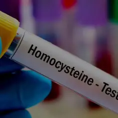 Ile kosztuje badanie homocysteina? Sprawdź ceny i oszczędź pieniądze