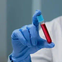 Ręka w niebieskiej rękawiczce trzyma probówkę z czerwoną cieczą. To może być próbka do badań pdw.