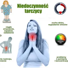 Ilustracja przedstawia objawy niedoczynności tarczycy: przyrost masy ciała, zmęczenie, bóle mięśni, wahania nastroju, suchą skórę, wypadanie włosów, problemy z pamięcią i koncentracją, wysoki cholesterol, nieregularne miesiączki.