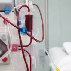 Czy dializy są do końca życia? Poznaj prawdę o leczeniu nerek