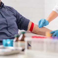 Co to jest PCT w badaniu krwi? Kluczowe informacje o prokalcytoninie
