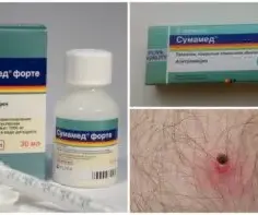 Jaki antybiotyk po ukąszeniu kleszcza? Poznaj ważne informacje!