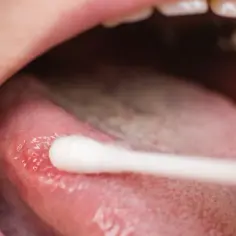 Do jakiego lekarza z językiem? Objawy, które wymagają wizyty