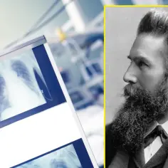 Portret Wilhelma Röntgena, odkrywcy promieniowania rentgenowskiego, obok zdjęć rentgenowskich płuc.