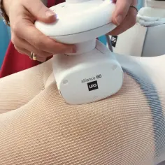 Endermologia integral czy alliance – która metoda jest skuteczniejsza?