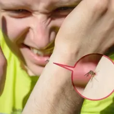 Bąble jak po ugryzieniu komara alergia: objawy i skuteczne leczenie