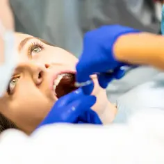 Jak wyrwać korzeń zęba bez bólu - krok po kroku do skutecznej ekstrakcji
