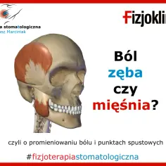 Napięte mięśnie żuchwy mogą być przyczyną bólu zęba. Anatomia czaszki z zaznaczonym mięśniem skroniowym.