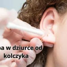 Ucho z kolczykiem, na którym widać ropę. Wacik kosmetyczny usuwa wydzielinę z dziurki po kolczyku.