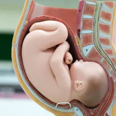 Model anatomiczny pokazuje dziecko w łonie matki, przygotowujące się do porodu. Widoczna jest pozycja płodu, która ułatwia wypinanie się dziecka przed porodem.