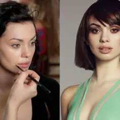 Czy modelka może mieć blizny? Przełamujemy stereotypy w modzie