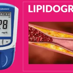 Badania na cholesterol czy na czczo? Kluczowe informacje, które musisz znać