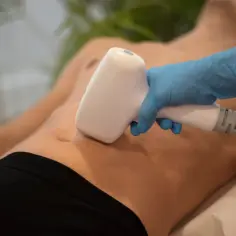 Zabieg depilacji laserowej brzucha. Dłoń w niebieskiej rękawiczce trzyma białe urządzenie, które emituje światło.